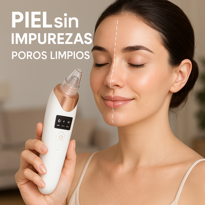 ClearSkin Suction Pro™ - Limpieza para tu piel